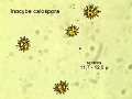 Inocybe calospora-amf1001-Spores